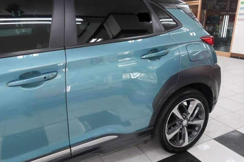 코나 덴트 작업 전 08