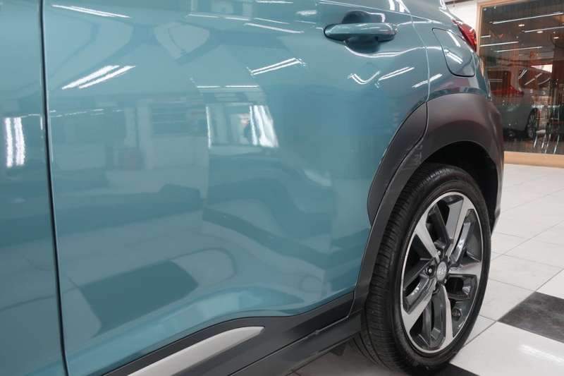 코나 덴트 작업 전 09