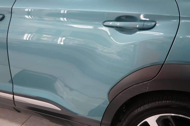 코나 덴트 작업 전 10